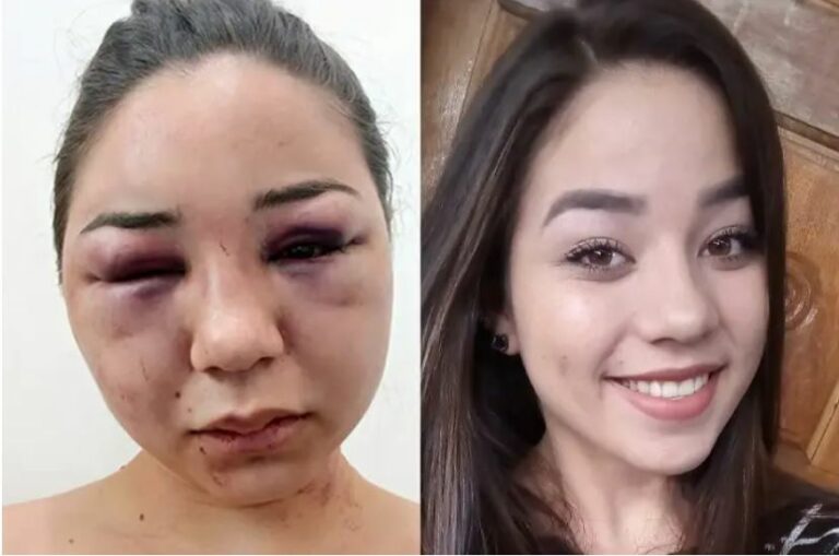Acusado de agredir e deixar jovem com rosto desfigurado em Tapejara é condenado