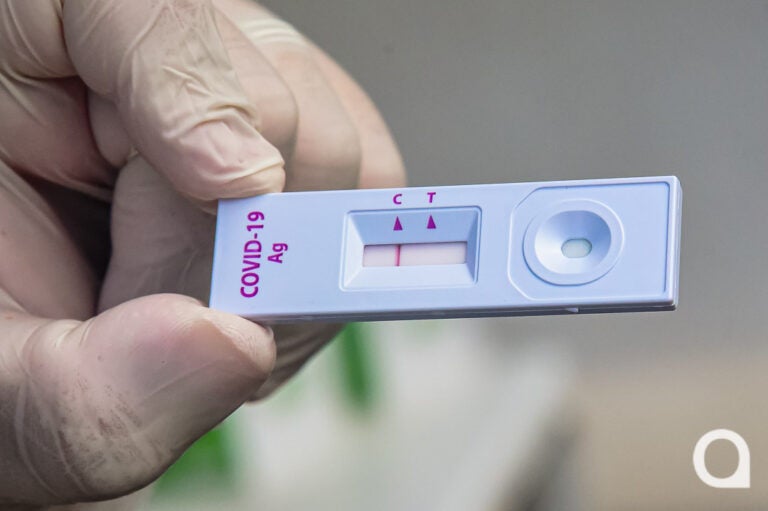 Pesquisadores descobrem maneira de prever gravidade da infecção em pacientes com Covid