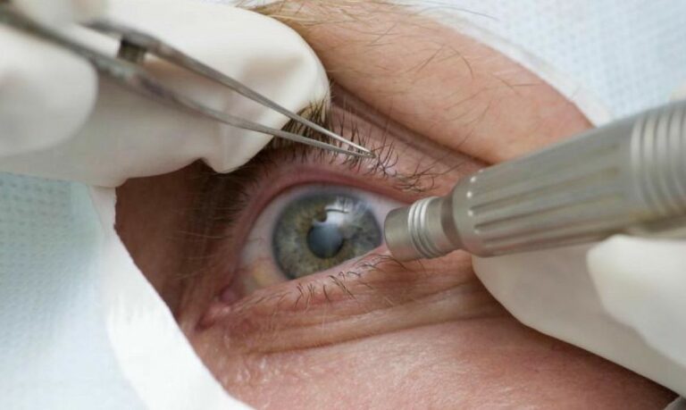 Demora em detectar doença ocular relacionada à idade pode levar à cegueira