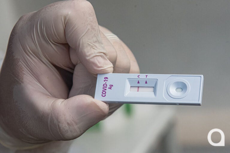 Saúde de Umuarama registra mais 87 novos casos de Covid; duas possíveis mortes não foram confirmadas
