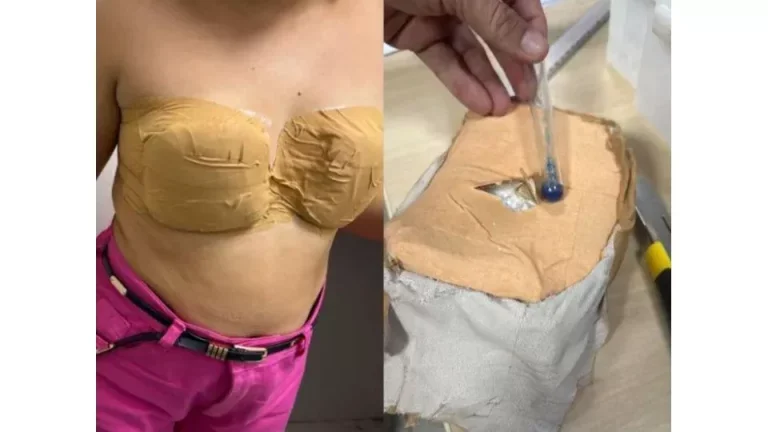 Jovem tenta embarcar para a Europa com sutiã de cocaína; ela foi presa por tráfico internacional