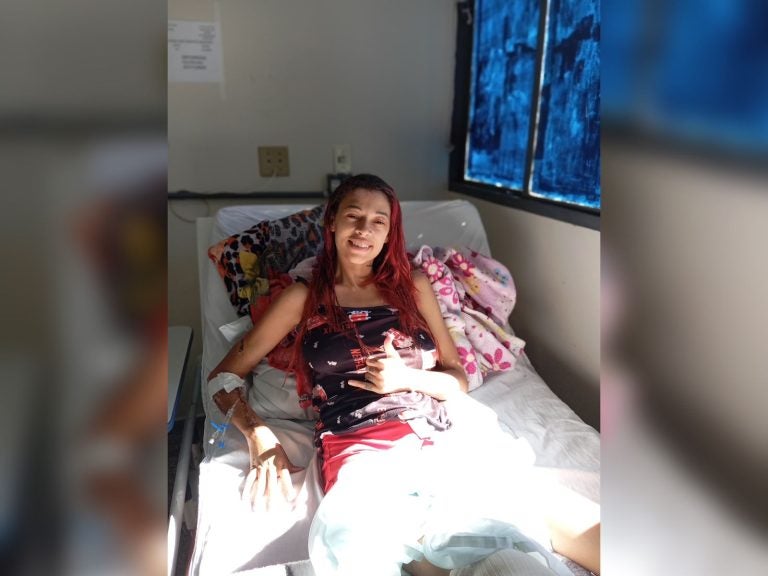 Jovem de Umuarama faz rifa para tratamento após perder perna em grave acidente