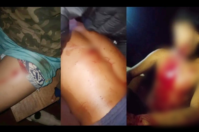 Ataqueyhovy 2025 01 03 Scaled