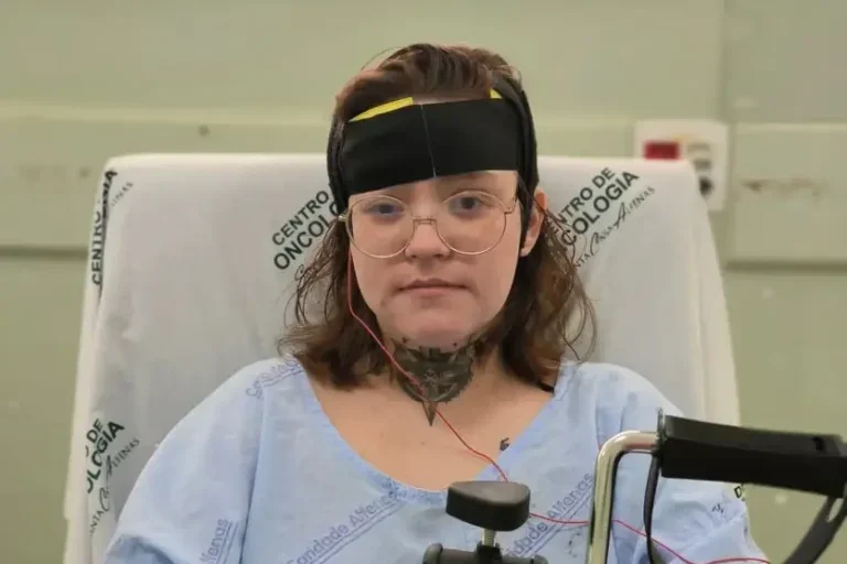 Foto de Carolina Arruda que é uma mulher branca e está sentada em uma cadeira de rodas com equipamentos médicos. Foto para ilustrar matéria sobre sua condição com a pior dor do mundo e ela estar cogitando a eutanásia.