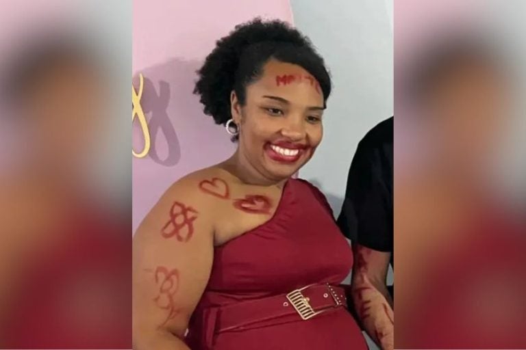 Gestante Atropelada Por Caminhão Dos Correios Morre No Hospital