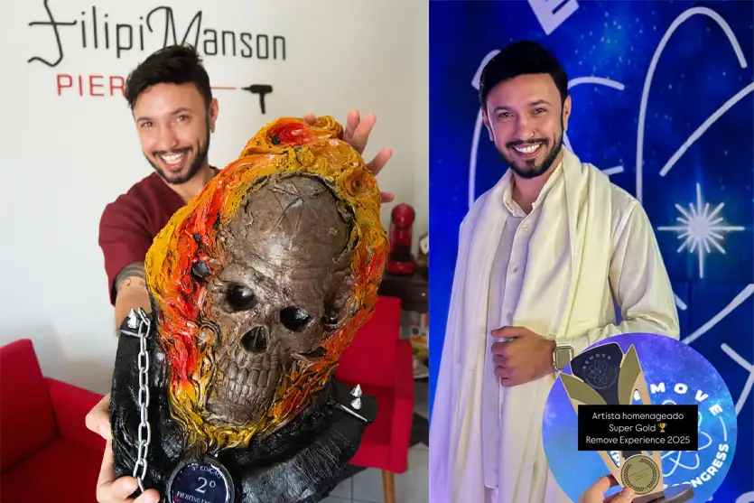 Filipi Manson é Destaque Em Congresso De Remoção A Laser (1)