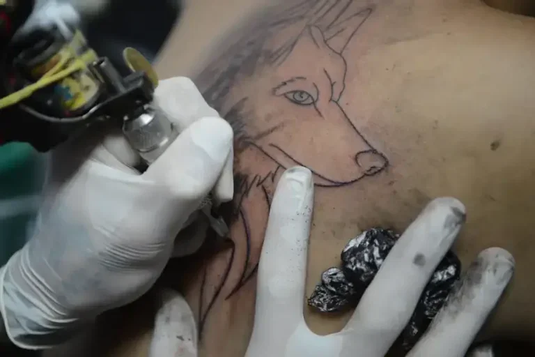 Anestesia para tatuagens: A exceção se limita a procedimentos com indicação médica, como pigmentação da aréola mamária, em casos de câncer de mama.