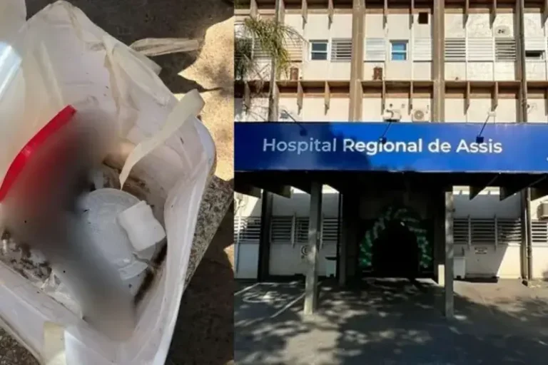 Pé humano: funcionários de uma cooperativa de reciclagem em Assis, interior de São Paulo, fizeram um achado macabro na manhã da última segunda-feira (08).