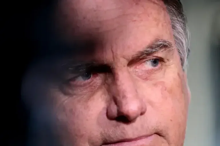 Bolsonaro tem crise de soluço e recebe atendimento médico