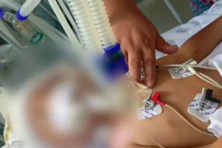 Criança De 2 Anos Abre Olhos 8 Dias Após Ser Baleada Na Cabeça