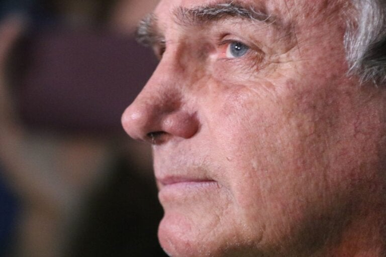 Internado na UTI, Bolsonaro apresenta melhora no quadro de pneumonia