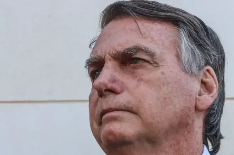 Internado em Brasília, Bolsonaro tem piora da função renal e aumento de inflamação
