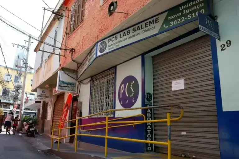 Morre paciente que recebeu transplante de órgão com vírus HIV