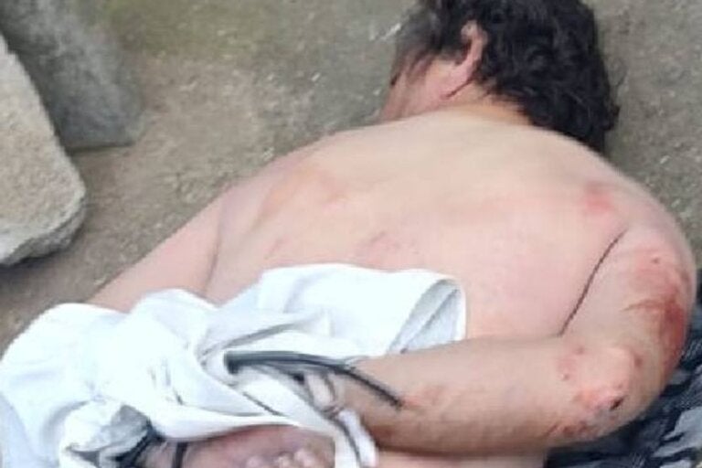 Suspeito de correr pelado atrás de mulheres e crianças acaba agredido e amarrado
