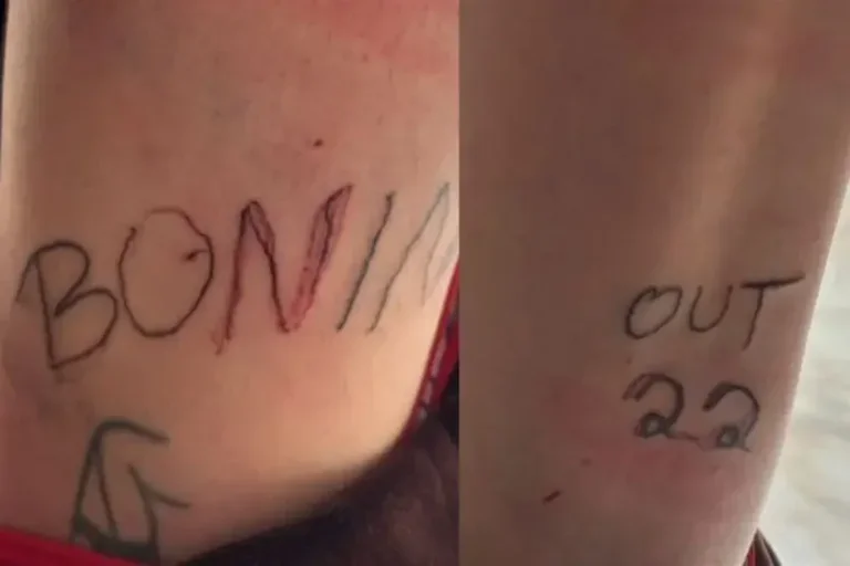 Homem é preso por tortura após tatuar namorada à força