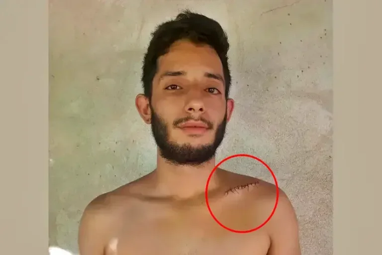 Motoboy de Umuarama faz vaquinha após acidente que o afastou do trabalho