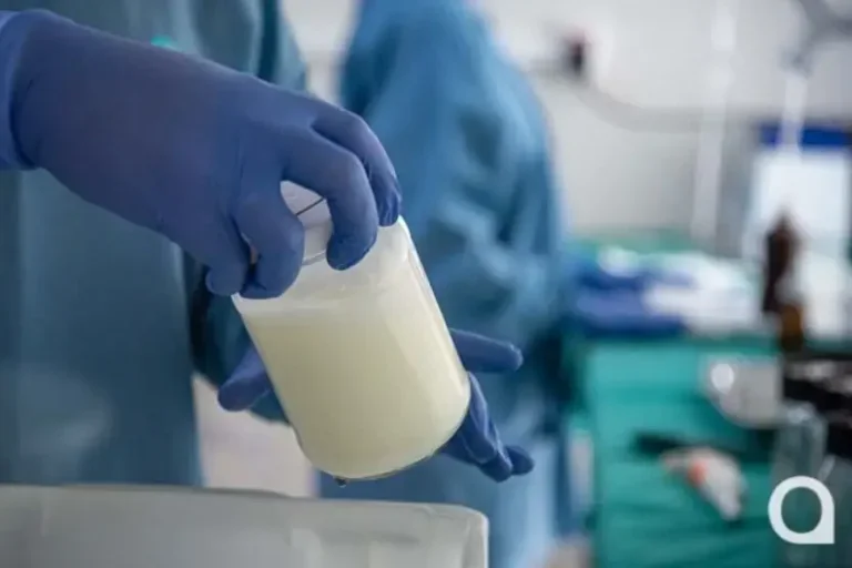 Doação de leite humano mobiliza Umuarama em campanha do BLH Norospar