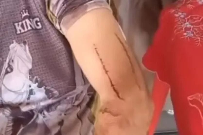Produtor enfrenta onça-parda em Toledo, reage ao ataque e escapa: “Acertei em cheio”