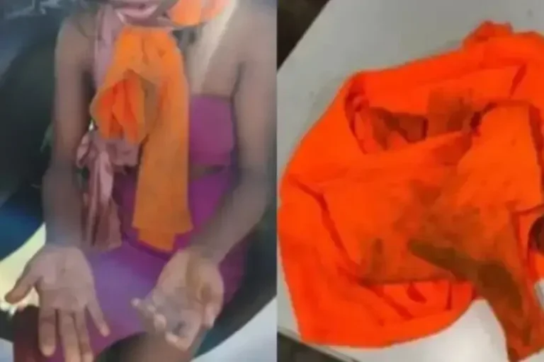 Colagem de fotos da mulher que sobreviveu ao ser jogada de cima da ponte e da blusa que ela vestia.