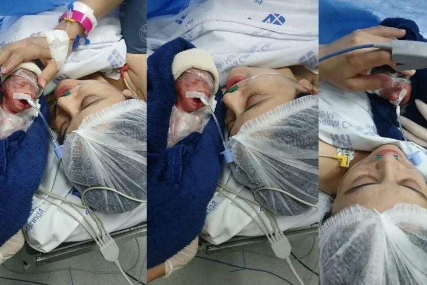 Após gestação raríssima, quadrigêmeas nascem em Maringá e encantam a família