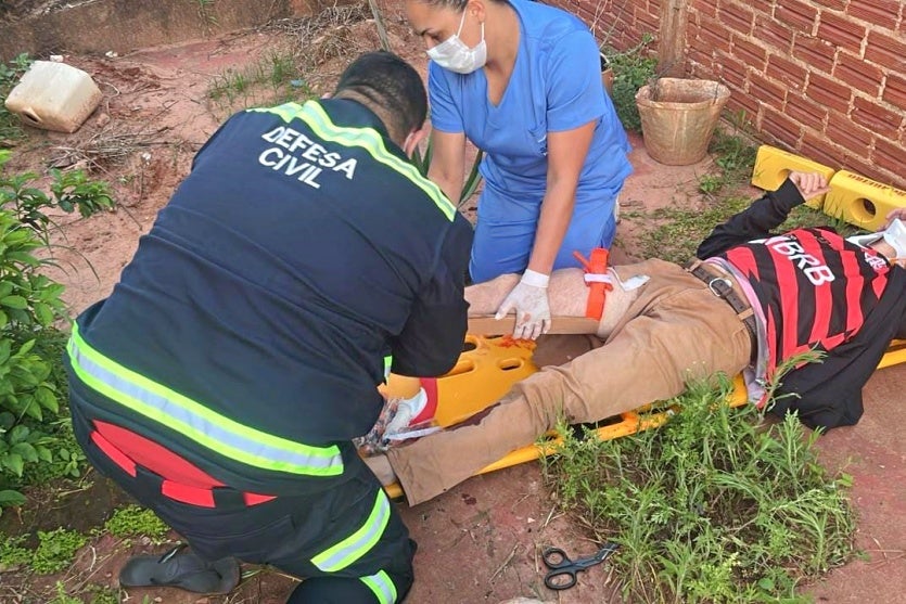 Iporã: Motociclista tem fratura exposta após desviar de carro, bater em muro e sofrer queda